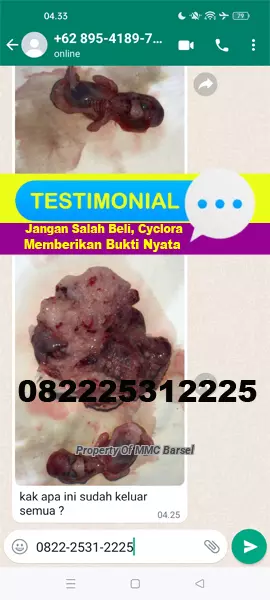 Testimoni%20Obat%20Aborsi%20Cytotec%20Cyclora%20Gastrul%20Misoprostol%20usia%204%20bulan.jpg